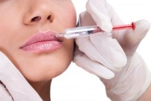dermal fillers dermal fillers