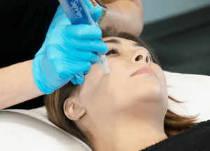 skinpen-microneedling-fda-approved-treatment-300x215 skinpen-microneedling-fda-approved-treatment-300x215