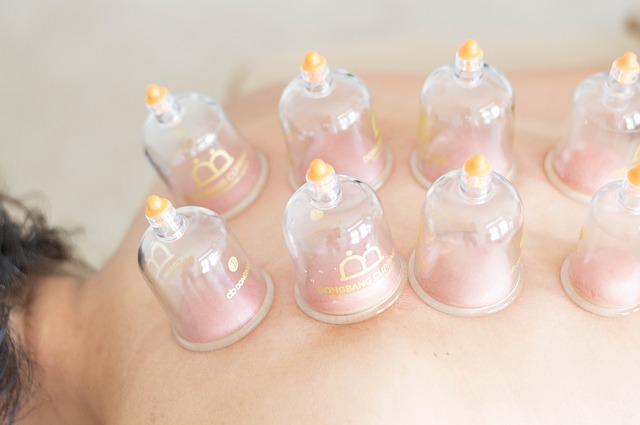 Woman receiving cupping treatment on back