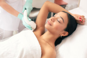 laser hair removal