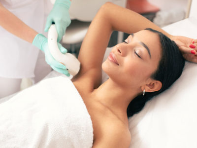 laser hair removal